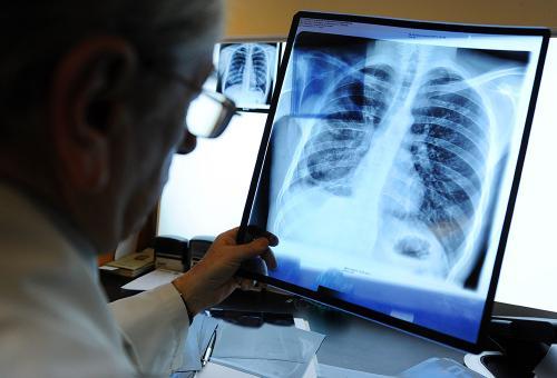 Ftiziatriya va pulmonologiyani rivojlantirishga – alohida e’tibor
