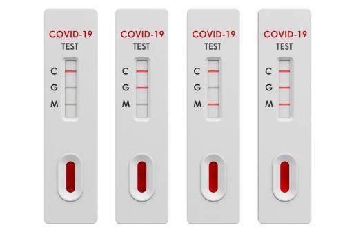 COVID-19 га экспресс тестлар сертификатлаштирмасдан олиб кирилади 